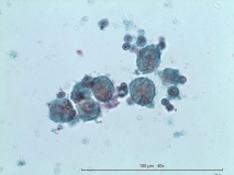 Атипичный микобактериоз у собаки породы цвергшнауцер. Жидкостная цитология. Рис. 8