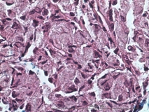 Атипичный микобактериоз у собаки породы цвергшнауцер. Клеточный блок (cell-block). Рис. 16