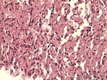 Атипичный микобактериоз у собаки породы цвергшнауцер. Клеточный блок (cell-block). Рис. 17