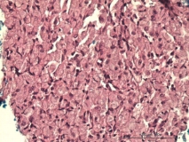 Атипичный микобактериоз у собаки породы цвергшнауцер. Клеточный блок (cell-block). Рис. 18