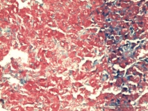 Атипичный микобактериоз у собаки породы цвергшнауцер. Клеточный блок (cell-block). Рис. 20