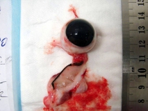 Цилиарная аденома задней камеры глаза у собаки породы лабрадор. Внешний вид глаза. Рис. 5