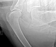 Эндогенная остеобластическая остеосаркома у собаки. Фото 6. Рентген поражённой плечевой кости