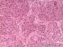 2-хкомпонентная опухоль у кошки сибирской породы. Рис. 5.