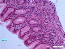 05 - Хронический дуоденит и гастрит у кошки породы сфинкс. Антральный отдел желудка. Гистология. Окраска гематоксилин-эозином.