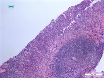 06 - Хронический дуоденит и гастрит у кошки породы сфинкс. Дно желудка. Гистология. Окраска гематоксилин-эозином.