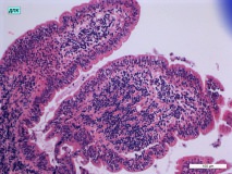 07 - Хронический дуоденит и гастрит у кошки породы сфинкс. Двенадцатиперстная кишка. Гистология. Окраска гематоксилин-эозином.