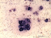 09 - Мастоцитома повышенной клеточности у собаки породы пудель.