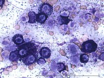 11 - Мастоцитома повышенной клеточности у собаки породы пудель.