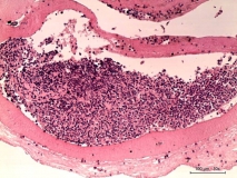 Мелкоклеточная лимфома у хорька. Гистология. Рис. 8.