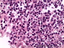 Мелкоклеточная лимфома у хорька. Гистология. Рис. 9.