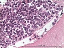 Мелкоклеточная лимфома у хорька. Гистология. Рис. 12.