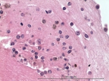 Мелкоклеточная лимфома у хорька. Гистология. Рис. 13.