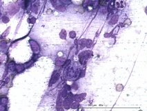 Т-клеточная лимфома у собаки породы бульмастиф. Рис. 1.