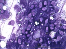 Т-клеточная лимфома у собаки породы бульмастиф. Рис. 2.