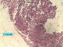 Т-клеточная лимфома у собаки породы бульмастиф. Рис. 8.