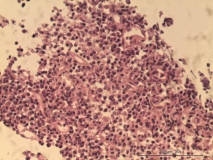 Т-клеточная лимфома у собаки породы бульмастиф. Рис. 9.