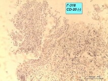 Т-клеточная лимфома у собаки породы бульмастиф. Рис. 12.