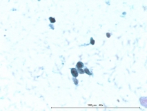 Т-клеточная лимфома у собаки породы бульмастиф. Рис. 16.