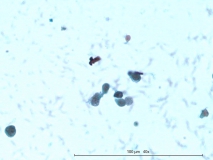Т-клеточная лимфома у собаки породы бульмастиф. Рис. 17.
