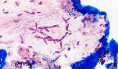Лимфоплазмоцитарный гастрит у собаки породы французский бульдог. Гистология. Рис. 1