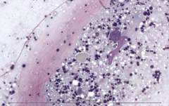 Лимфоплазмоцитарный гастрит у собаки породы французский бульдог. Рис. 9
