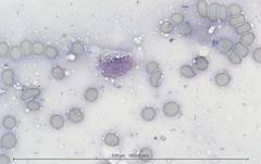 Некротический гранулематозный лимфаденит у кошки. Цитология. Рис 6