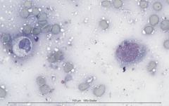 Некротический гранулематозный лимфаденит у кошки. Цитология. Рис 7