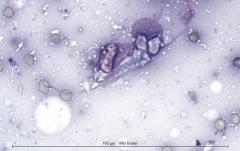 Некротический гранулематозный лимфаденит у кошки. Цитология. Рис 9