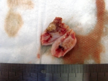 Папиллярная эндометриальная карцинома матки у кошки. Внешний вид. Рис. 2