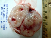 Пример фибросаркомы. Рис. 1. Внешний вид опухоли.