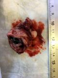 Увеальный меланоз у собаки .  Глазное яблока после энуклеации. Рис. 2